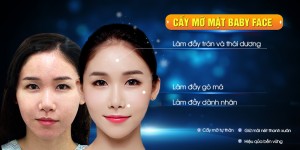 cay-mo-mat-dich-vu