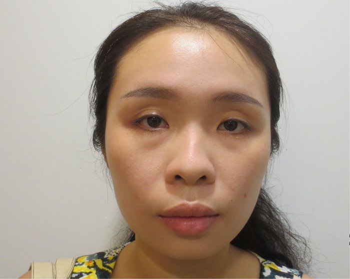 Gương mặt của Việt Trang không có điểm nhấn khiến cô ở bị đóng khuôn trong một kiểu vai diễn