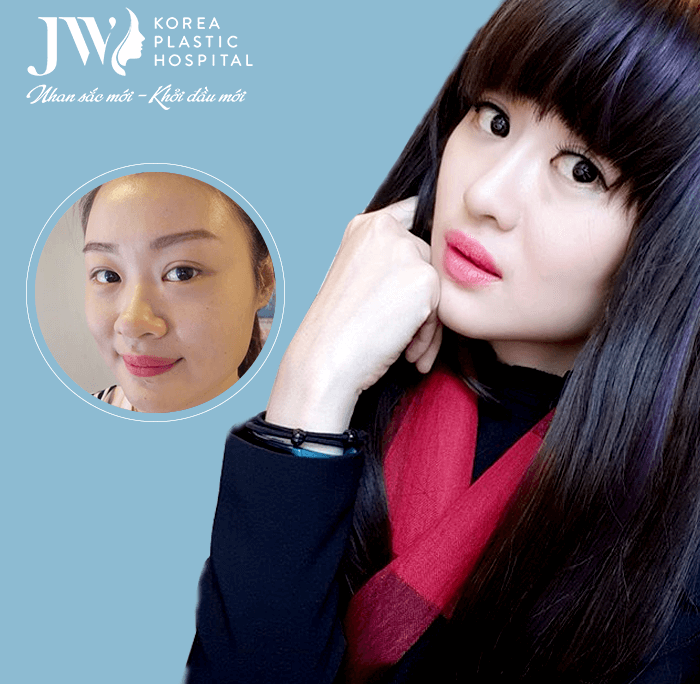 Lean Yee Lings- a girl Singapore