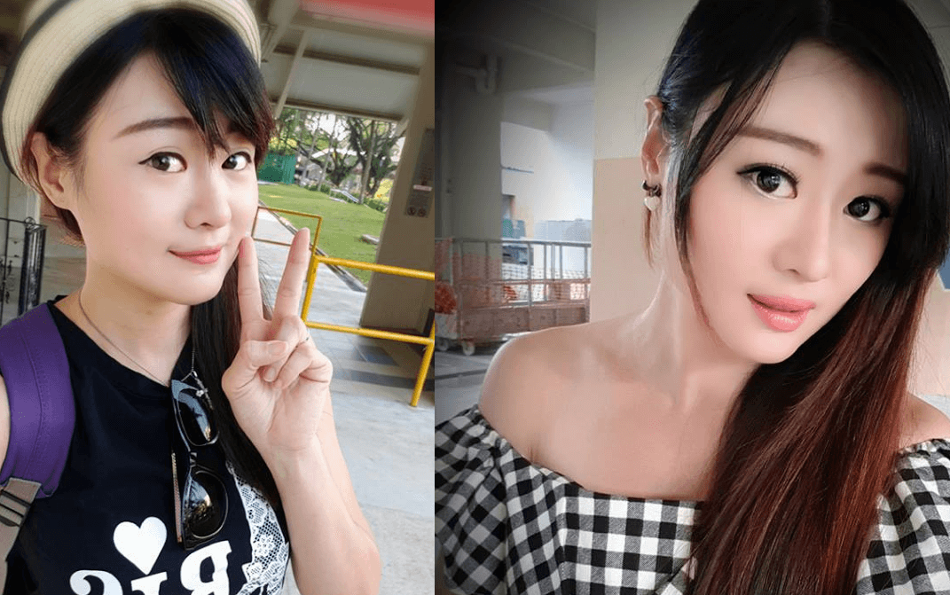 She has S line Plus shape after surgery