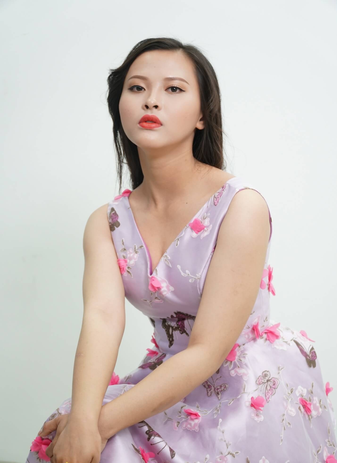 Thu Henry - Double Eyelid Surgery - Image 2