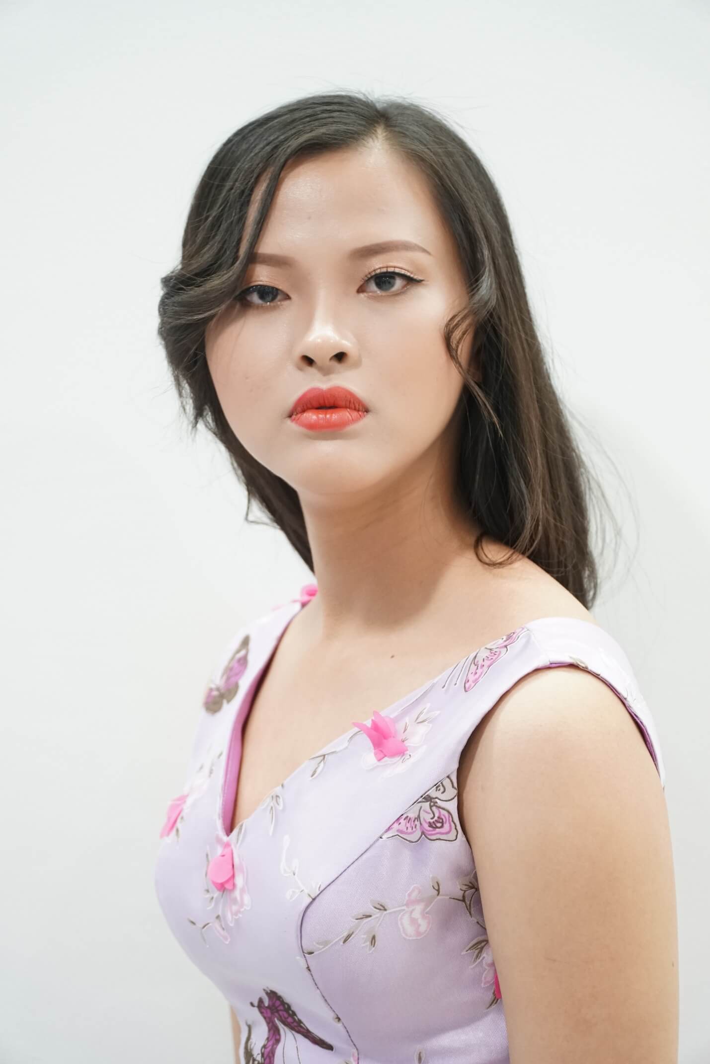 Thu Henry - Double Eyelid Surgery - Image 3