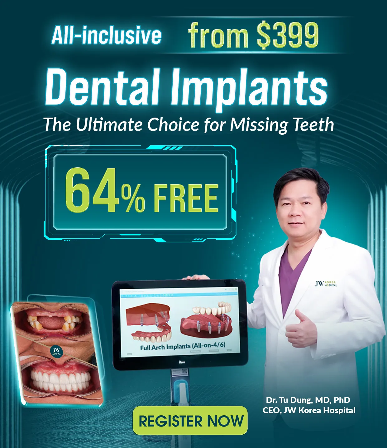 Banner dental implant