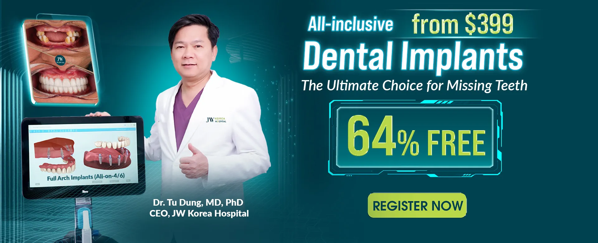Banner dental implant