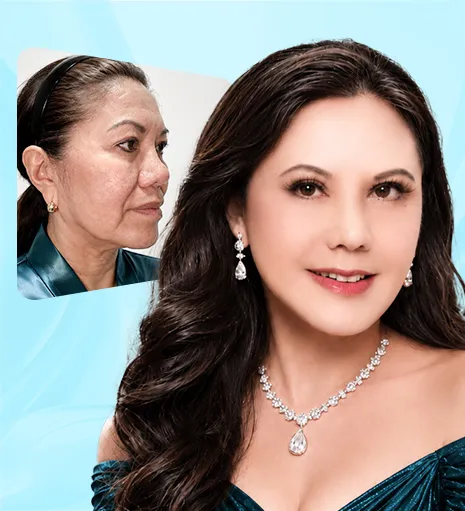 Image of cusomter before and after