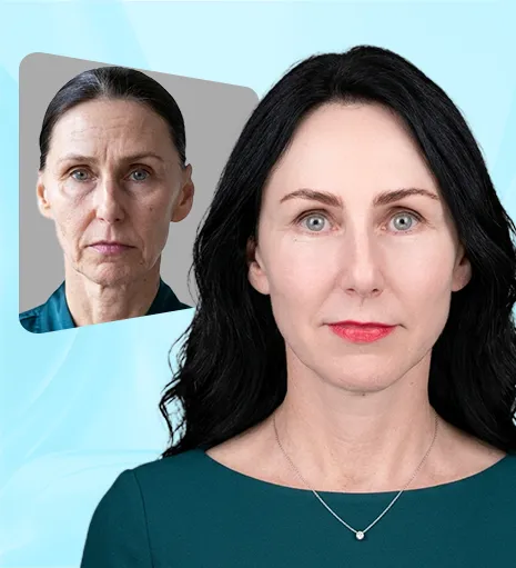 Image of cusomter before and after