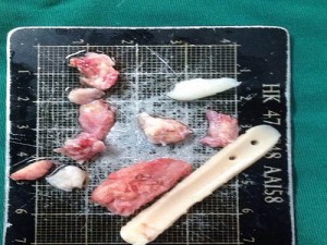 bệnh viện thẩm mỹ jw hàn quốc