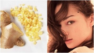 tẩy nốt ruồi 1