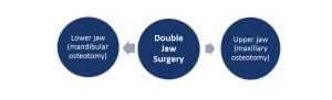 Jaw surgery may be performed on the upper jaw, lower jaw or both