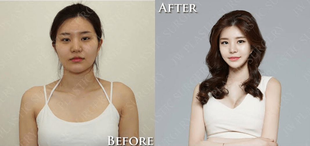Before / After