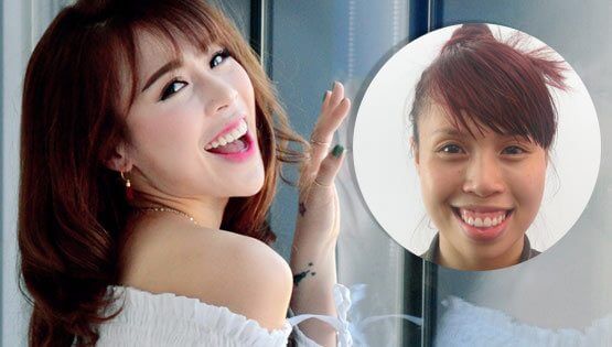 Vũ công Lan Nhi – trước và sau