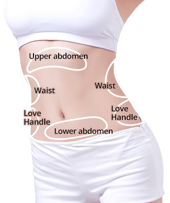 Abdomen Liposuction