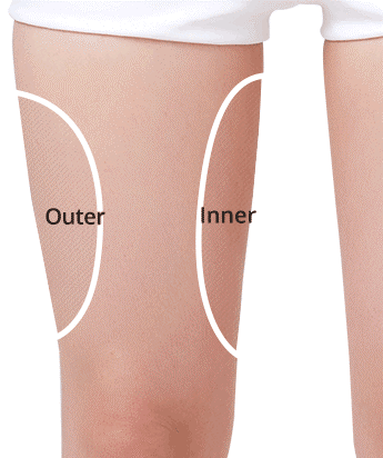 Thighs Liposuction
