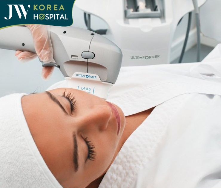 Smooth, firm, and rejuvenated facial skin after a single HIFU treatment