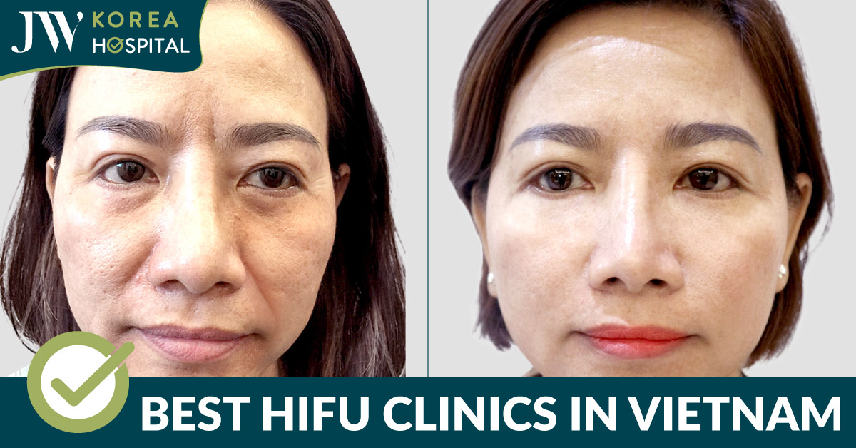 Top 5 Trusted HIFU Clinics in Vietnam Worth Exploring
